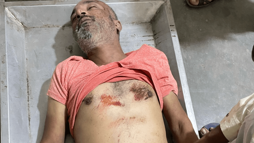 A car rider beat up an e-rickshaw driver