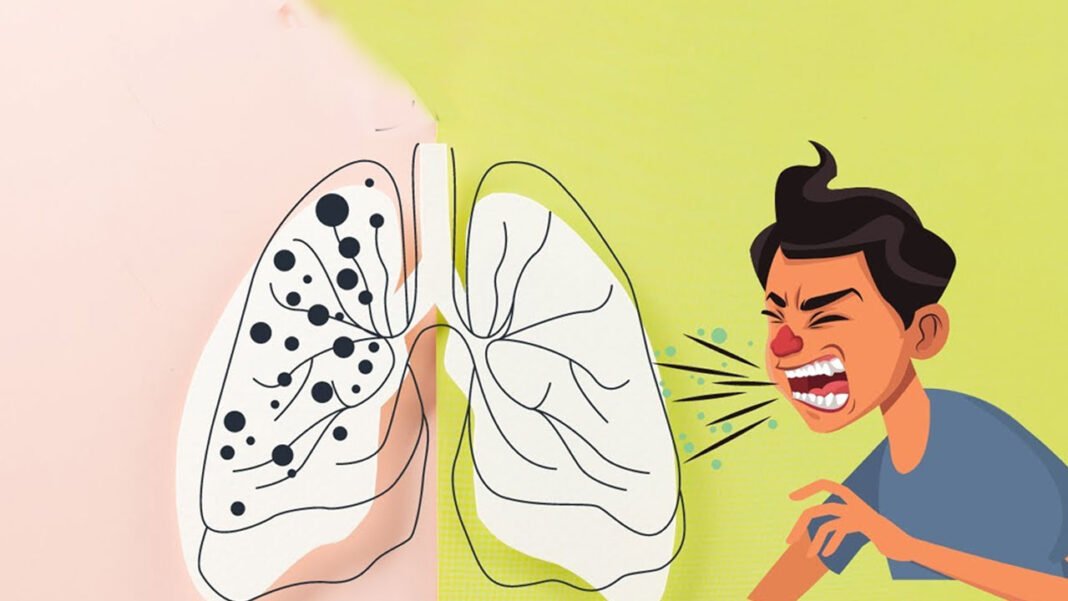 Symptoms of TB and its prevention